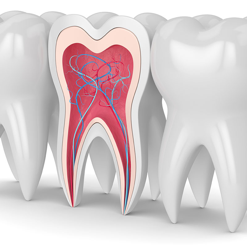 Root Canal Treatment | Ambleside | Zebra Dental
