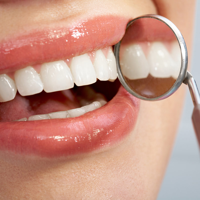 Teeth Whitening | Ambleside | Zebra Dental 