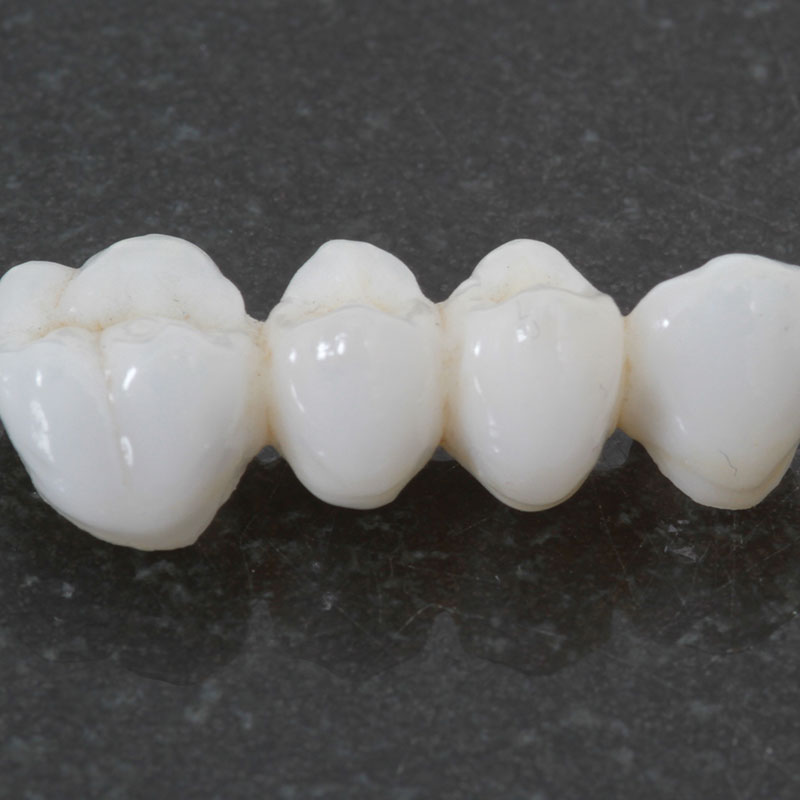 Dental Bridges | Kendal | Zebra Dental